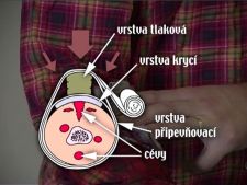 Prvn pomoc I
